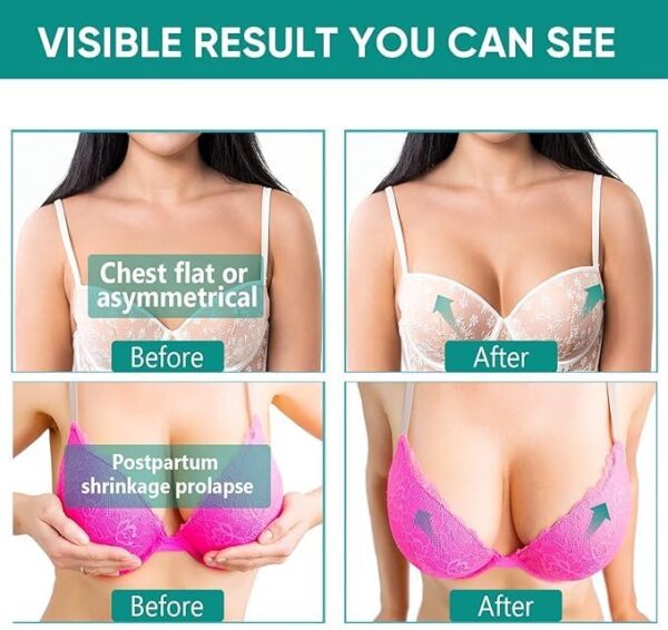 Generic Breast Enhancement Pills in Pakistan