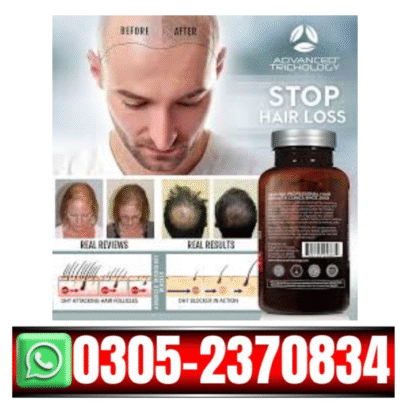 DHT Blocker Hair Growth Supplement